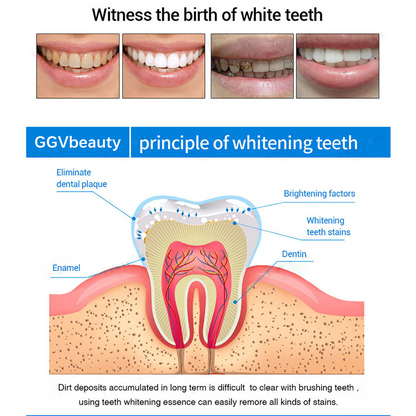 Teeth Whitening Essence
