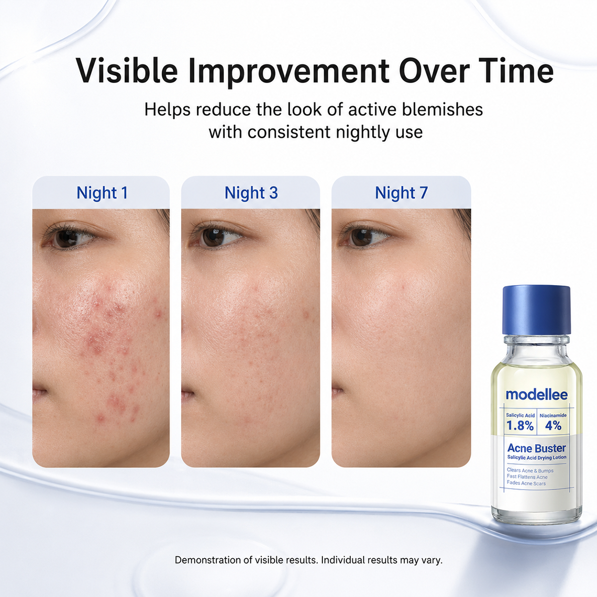 anti-acne serum