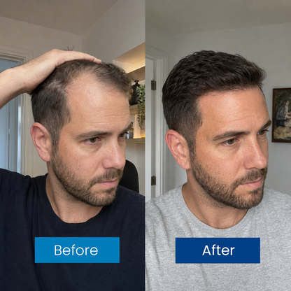 Hair Growth Roll on Serum