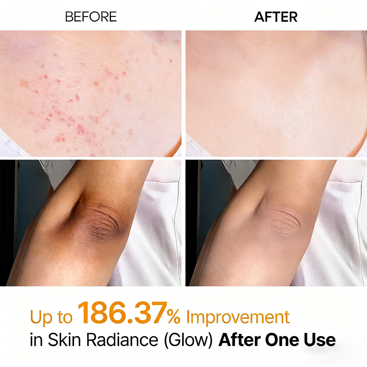 Peeling Shot Keratin Care Kojic Acid Turmeric Spray